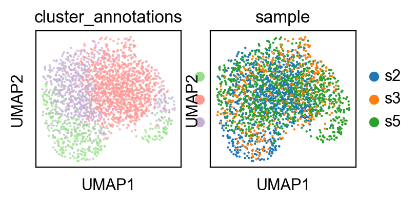 ../_images/tutorials_Spatiotemporal_Regulatory_Analysis_of_Tumors_19_1.png
