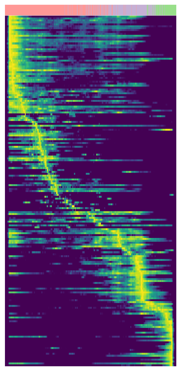 ../_images/tutorials_Spatiotemporal_Regulatory_Analysis_of_Tumors_41_0.png