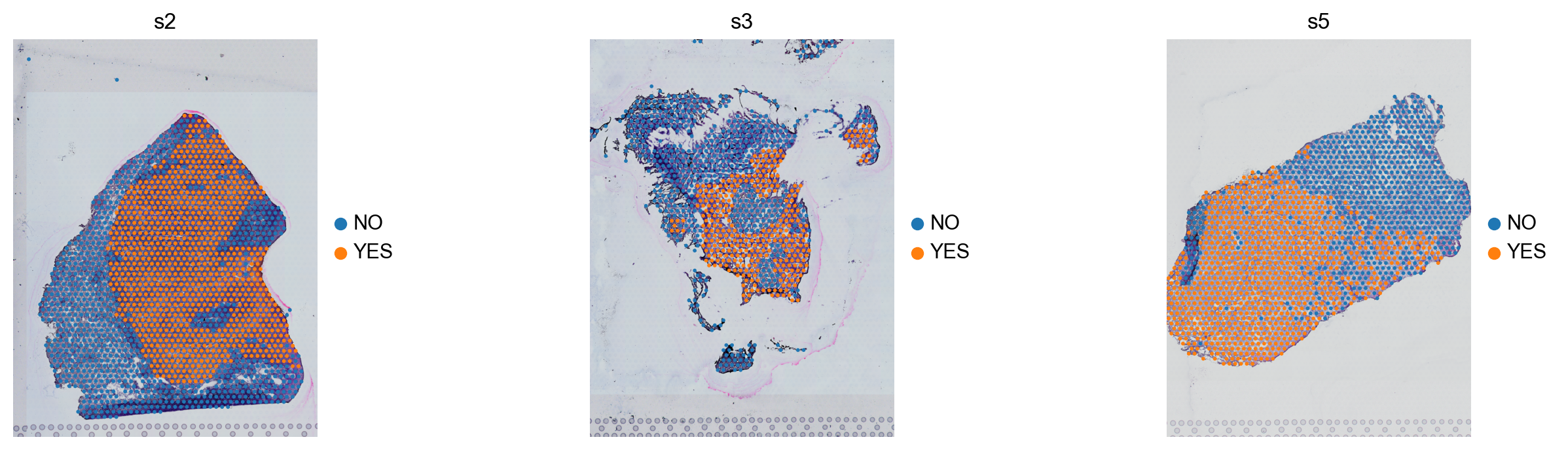 ../_images/tutorials_Spatiotemporal_Regulatory_Analysis_of_Tumors_7_1.png